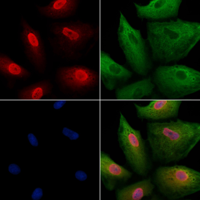 PCP4 Antibody in Immunocytochemistry (ICC/IF)