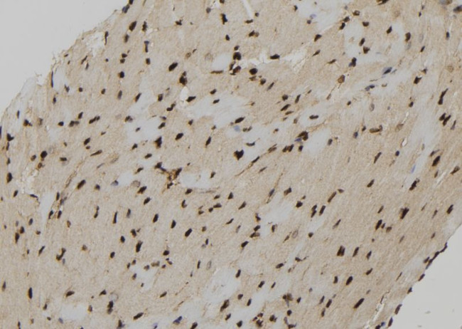 PPP3R2 Antibody in Immunohistochemistry (Paraffin) (IHC (P))