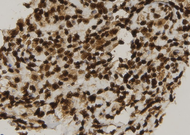 CIB4 Antibody in Immunohistochemistry (Paraffin) (IHC (P))
