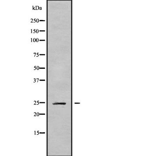 CABP2 Antibody in Western Blot (WB)