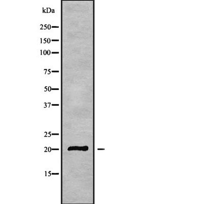 CABP5 Antibody in Western Blot (WB)