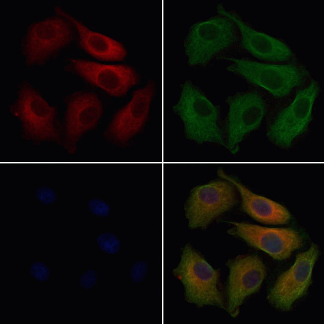 CABP4 Antibody in Immunocytochemistry (ICC/IF)