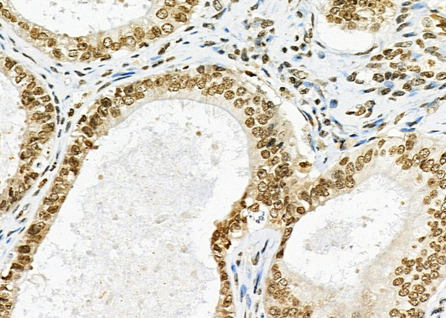 CAMTA2 Antibody in Immunohistochemistry (Paraffin) (IHC (P))