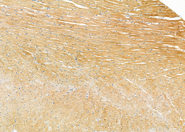 ARPP19 Antibody in Immunohistochemistry (Paraffin) (IHC (P))