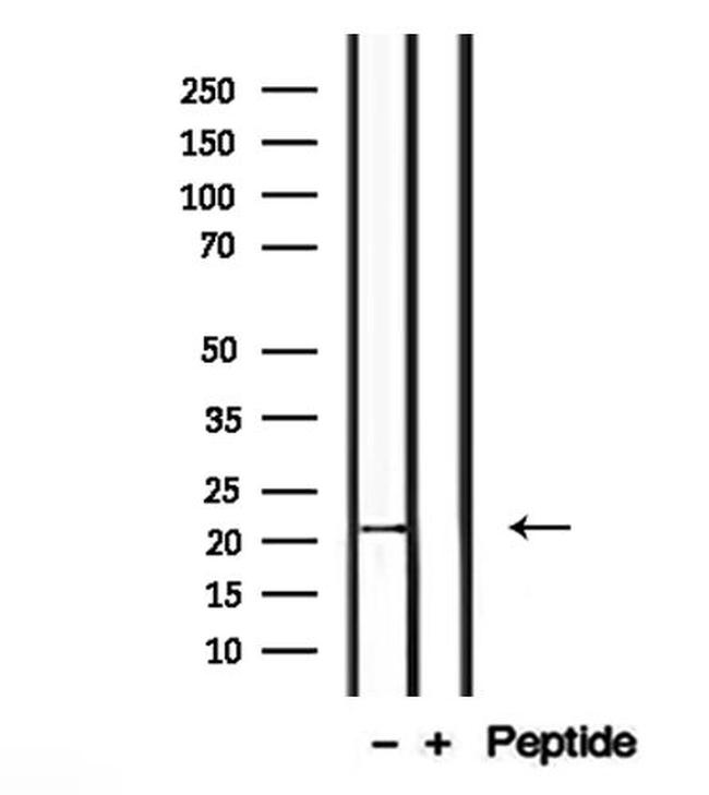 CTAG2 Antibody in Western Blot (WB)