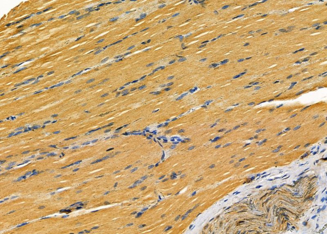 CHST3 Antibody in Immunohistochemistry (Paraffin) (IHC (P))