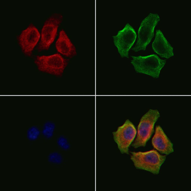 CA7 Antibody in Immunocytochemistry (ICC/IF)