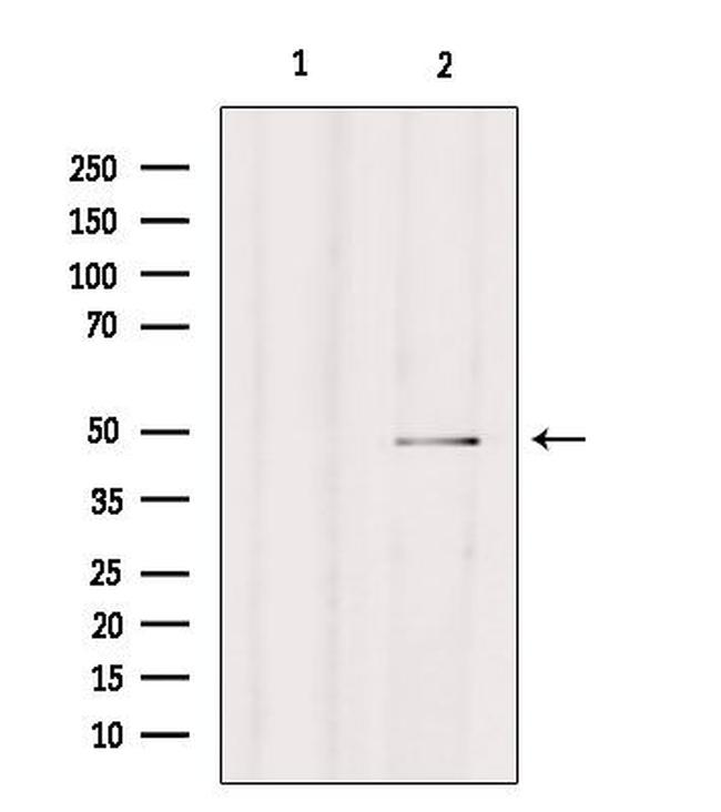 Carboxypeptidase A4 Antibody in Western Blot (WB)