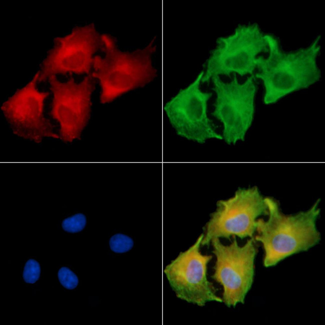 CPXM2 Antibody in Immunocytochemistry (ICC/IF)