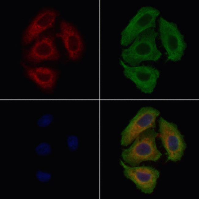 CATSPER3 Antibody in Immunocytochemistry (ICC/IF)