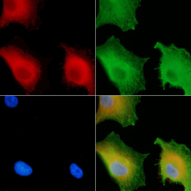 CATSPER4 Antibody in Immunocytochemistry (ICC/IF)