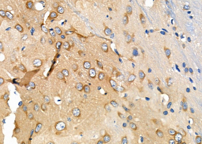 M6PR Antibody in Immunohistochemistry (Paraffin) (IHC (P))
