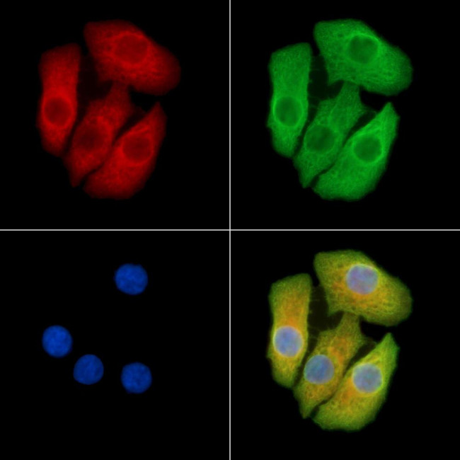 CRABP1 Antibody in Immunocytochemistry (ICC/IF)