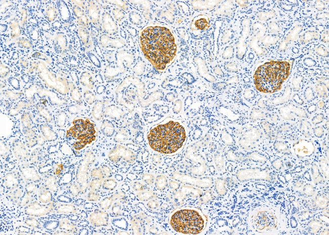 CDR1 Antibody in Immunohistochemistry (Paraffin) (IHC (P))