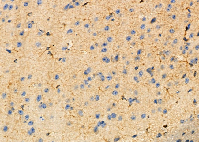 CKLF Antibody in Immunohistochemistry (Paraffin) (IHC (P))