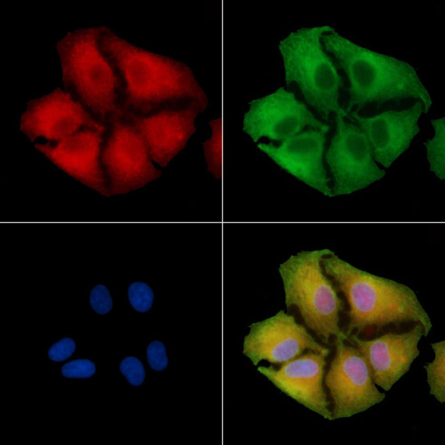 CLCNKB Antibody in Immunocytochemistry (ICC/IF)