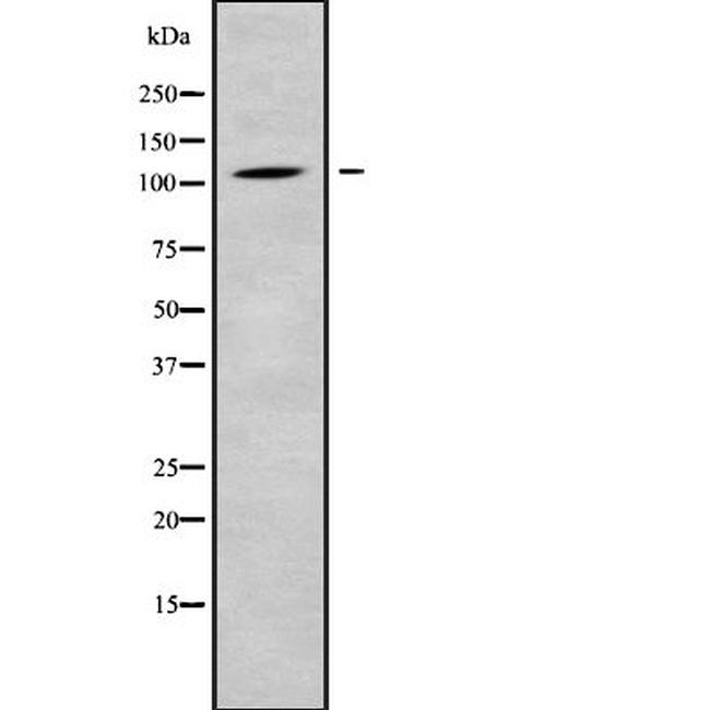 CLCN1 Antibody in Western Blot (WB)