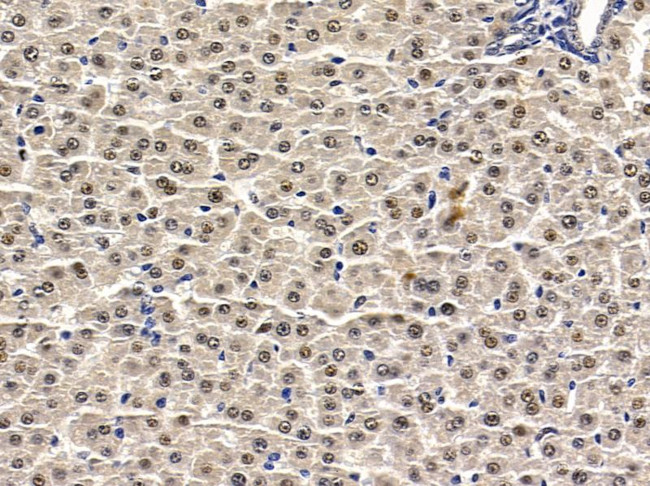 CHD6 Antibody in Immunohistochemistry (Paraffin) (IHC (P))