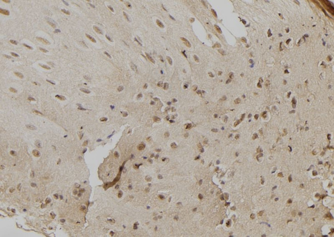CHD8 Antibody in Immunohistochemistry (Paraffin) (IHC (P))