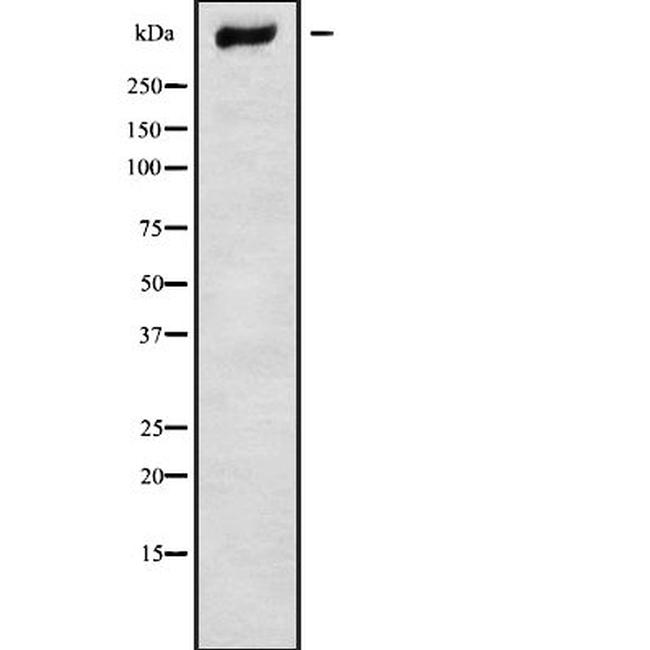 CHD9 Antibody in Western Blot (WB)