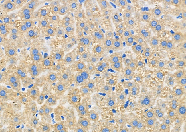 CMTM8 Antibody in Immunohistochemistry (Paraffin) (IHC (P))