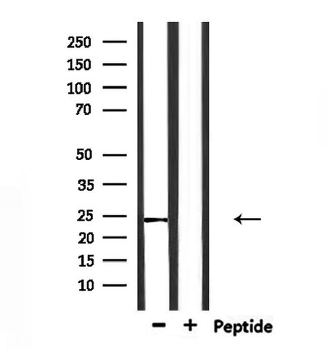 Claudin 20 Antibody in Western Blot (WB)