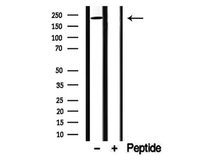 DENND4A Antibody in Western Blot (WB)