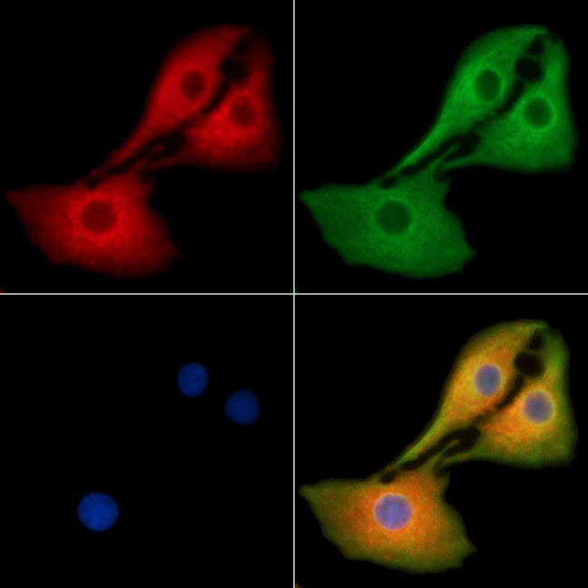 Factor XIII B Antibody in Immunocytochemistry (ICC/IF)