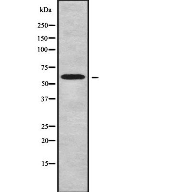 CCDC8 Antibody in Western Blot (WB)