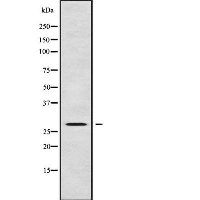 C1QTNF8 Antibody in Western Blot (WB)