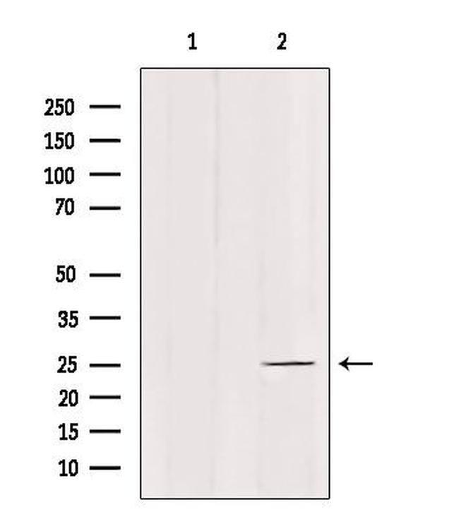 C1QL4 Antibody in Western Blot (WB)