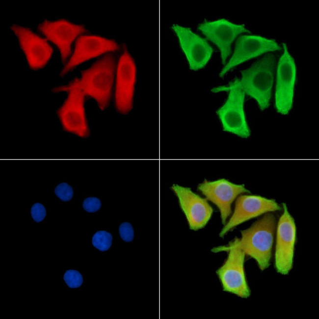 CD35 Antibody in Immunocytochemistry (ICC/IF)