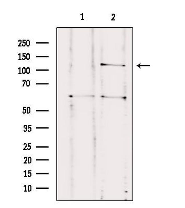 CNTNAP3 Antibody in Western Blot (WB)