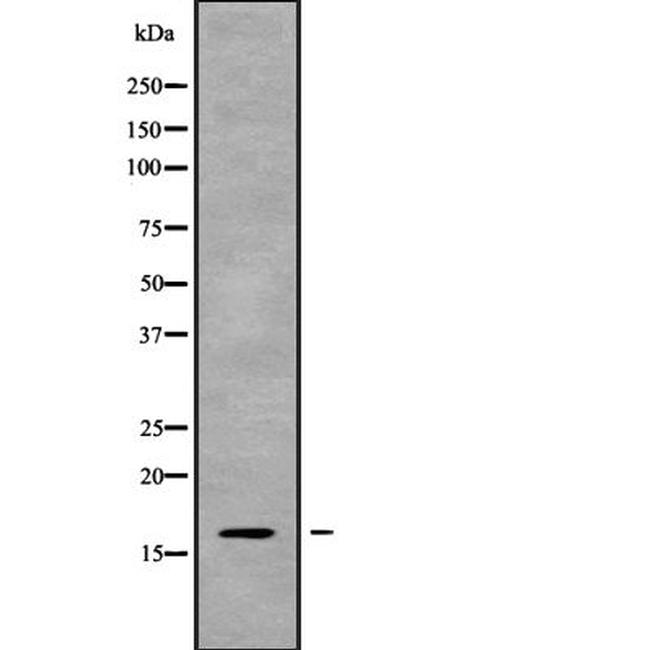 Cystatin 8 Antibody in Western Blot (WB)
