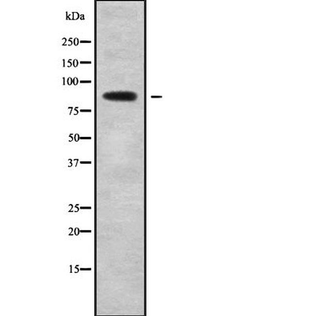 PLA2G4B Antibody in Western Blot (WB)
