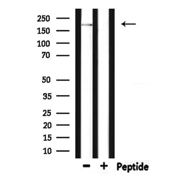 DOCK7 Antibody in Western Blot (WB)