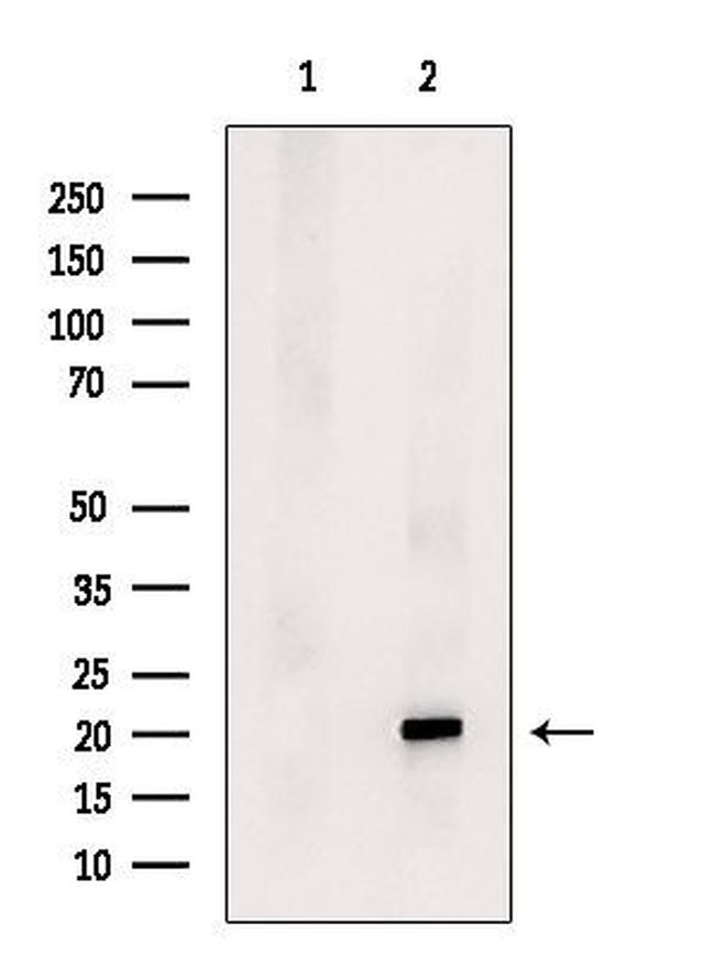 HSD17B14 Antibody in Western Blot (WB)