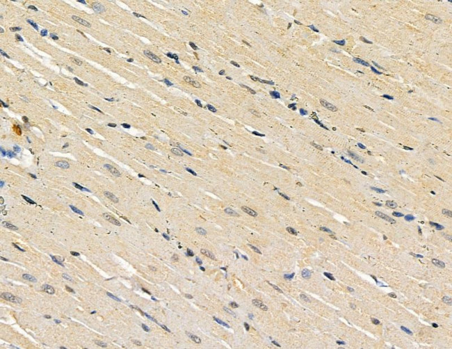 POLE2 Antibody in Immunohistochemistry (Paraffin) (IHC (P))