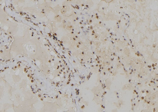 POLA2 Antibody in Immunohistochemistry (Paraffin) (IHC (P))