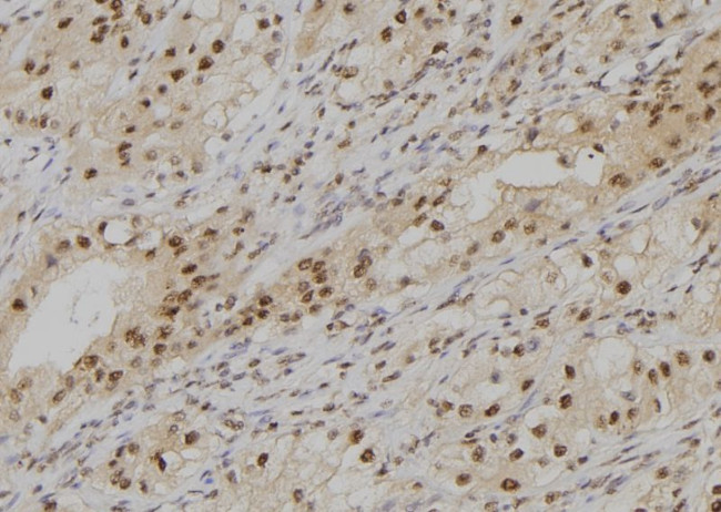 POLD4 Antibody in Immunohistochemistry (Paraffin) (IHC (P))
