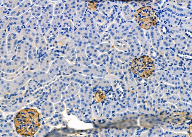 POLG Antibody in Immunohistochemistry (Paraffin) (IHC (P))
