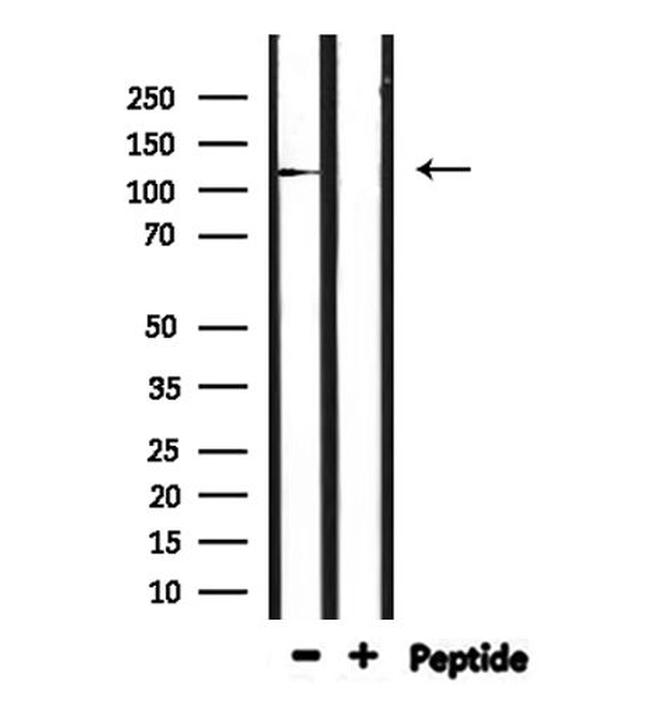 IGHMBP2 Antibody in Western Blot (WB)