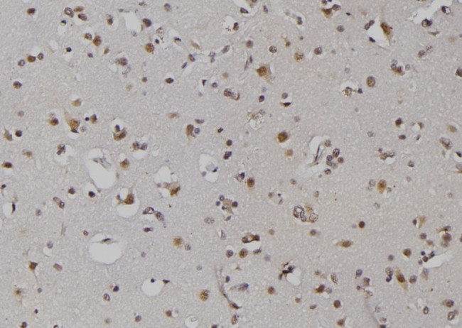 ZNRD1 Antibody in Immunohistochemistry (Paraffin) (IHC (P))