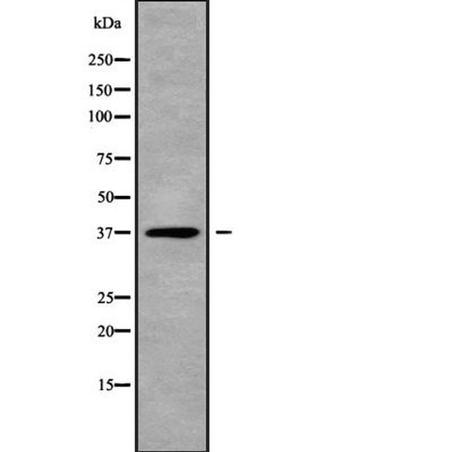 TWISTNB Antibody in Western Blot (WB)