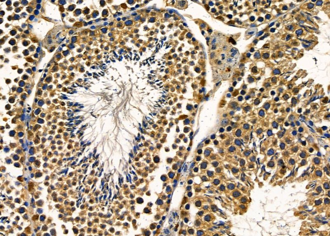 POLR2H Antibody in Immunohistochemistry (Paraffin) (IHC (P))