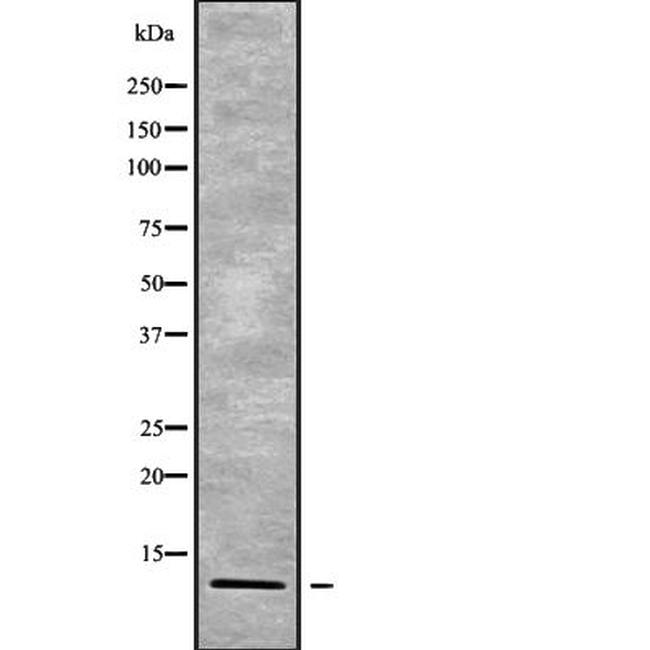 POLR2K Antibody in Western Blot (WB)