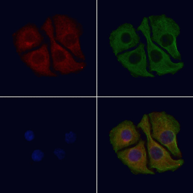 Dynactin 4 Antibody in Immunocytochemistry (ICC/IF)
