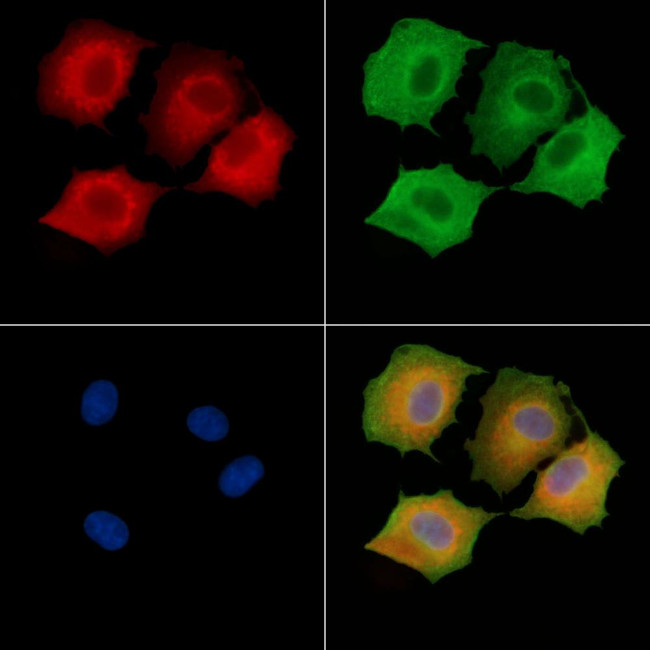 DNAL4 Antibody in Immunocytochemistry (ICC/IF)