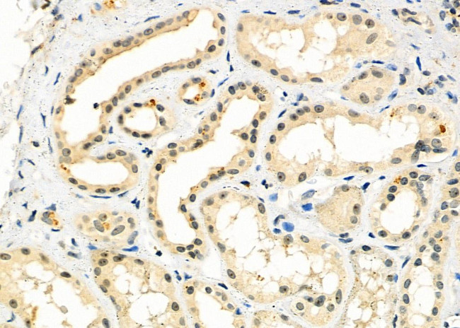 HECTD1 Antibody in Immunohistochemistry (Paraffin) (IHC (P))