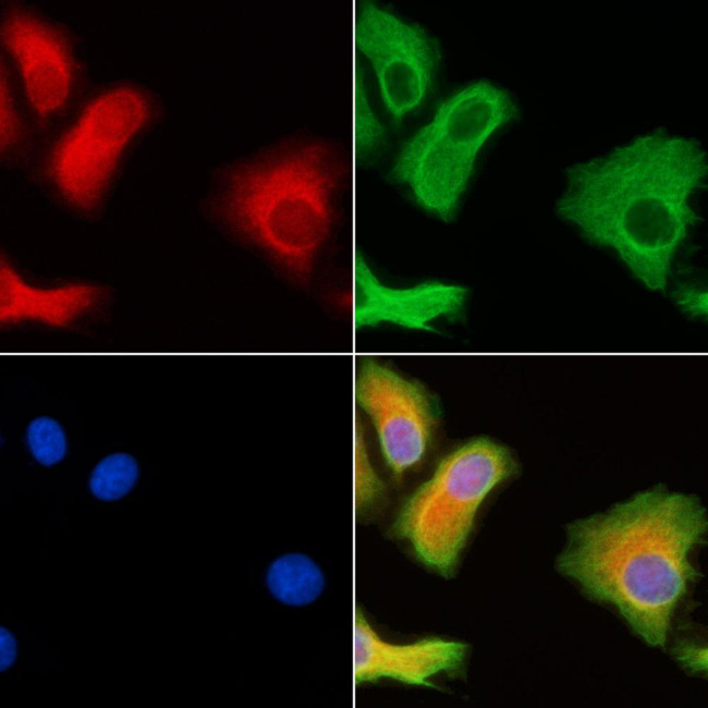 TEB4 Antibody in Immunocytochemistry (ICC/IF)